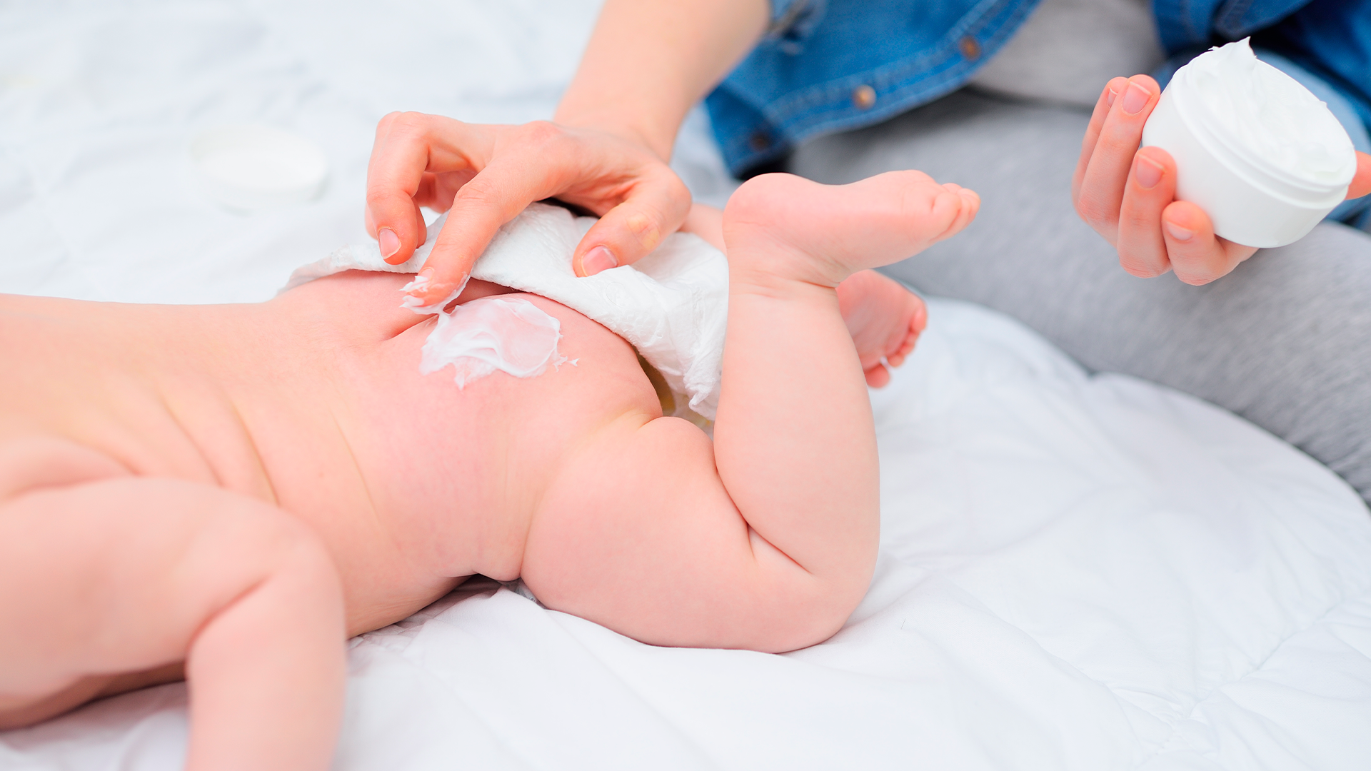 Bebé recibe aplicación de pomada por irritación de pañal